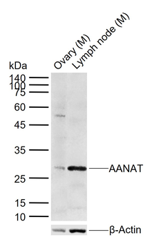 AANAT Rabbit Polyclonal Antibody