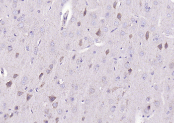 BMAL1 Rabbit Polyclonal Antibody