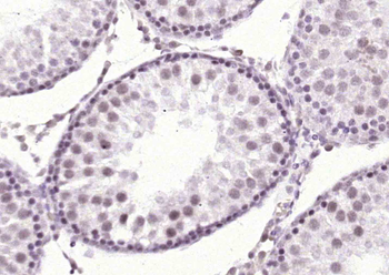 AKR1D1 Rabbit Polyclonal Antibody