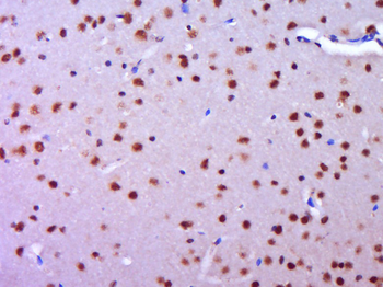 Phospho-AR/Androgen receptor (Ser597) Rabbit Polyclonal Antibody