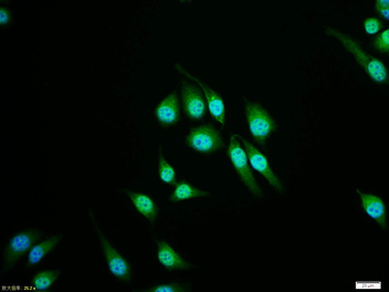 Phospho-AR/Androgen receptor (Ser597) Rabbit Polyclonal Antibody