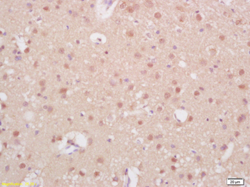 Phospho-AR/Androgen receptor (Ser597) Rabbit Polyclonal Antibody