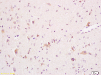 ARSA Rabbit Polyclonal Antibody