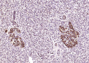 Phospho-ATF2 (Thr69/71) Rabbit Polyclonal Antibody