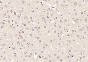Phospho-ATF2 (Thr69/71) Rabbit Polyclonal Antibody
