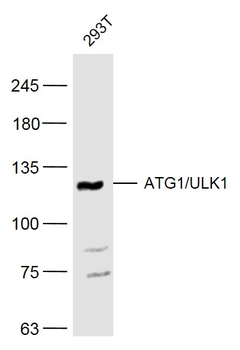 ATG1/ULK1 Rabbit Polyclonal Antibody