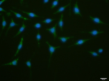 ATG1/ULK1 Rabbit Polyclonal Antibody