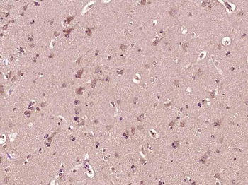 ATG4A Rabbit Polyclonal Antibody