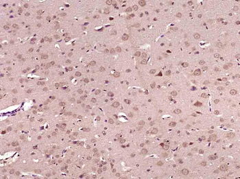 ATG4A Rabbit Polyclonal Antibody