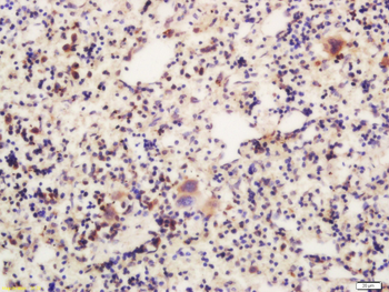 ATG16L Rabbit Polyclonal Antibody