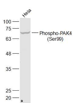 Phospho-PAK4 (Ser99) Rabbit Polyclonal Antibody