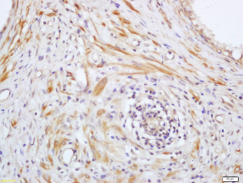 Phospho-PAK4 (Ser99) Rabbit Polyclonal Antibody