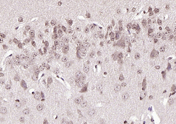 Phospho-BRAF (Ser365) Rabbit Polyclonal Antibody