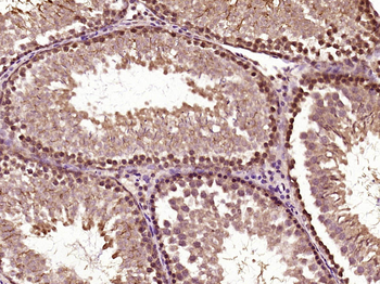 Phospho-BRAF (Ser365) Rabbit Polyclonal Antibody