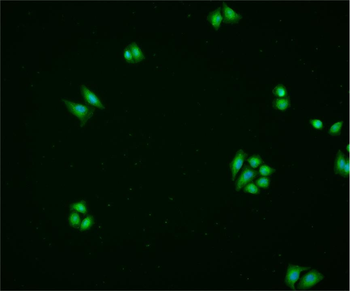CA9 Rabbit Polyclonal Antibody
