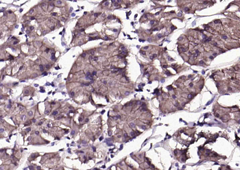 CA9 Rabbit Polyclonal Antibody
