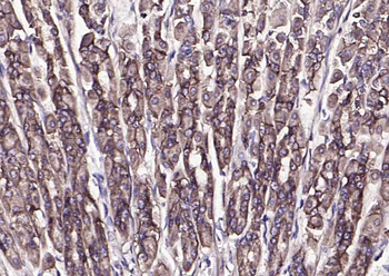 CA9 Rabbit Polyclonal Antibody