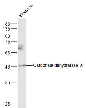 CA9 Rabbit Polyclonal Antibody