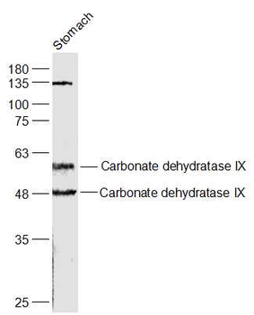 CA9 Rabbit Polyclonal Antibody