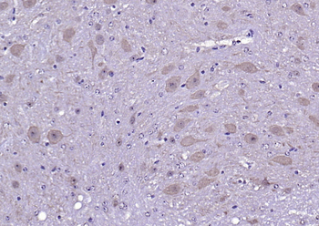 Calmodulin 1/2/3 Rabbit Polyclonal Antibody