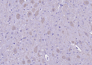 Calmodulin 1/2/3 Rabbit Polyclonal Antibody