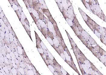 Calmodulin 1/2/3 Rabbit Polyclonal Antibody