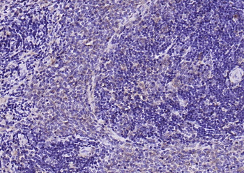 Calmodulin 1/2/3 Rabbit Polyclonal Antibody