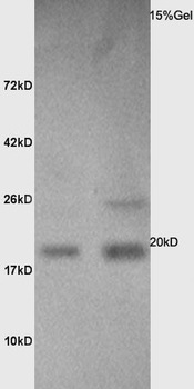 Calmodulin 1/2/3 Rabbit Polyclonal Antibody