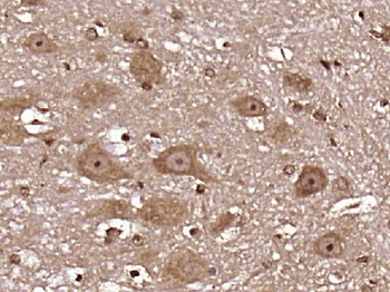 Phospho-Caspase-9 (Thr125) Rabbit Polyclonal Antibody
