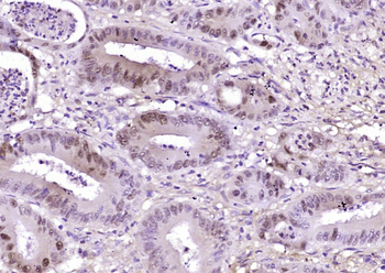 Phospho-Beta-Catenin (Ser33 + Ser37) Rabbit Polyclonal Antibody