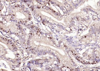 Phospho-Beta-Catenin (Ser33 + Ser37) Rabbit Polyclonal Antibody