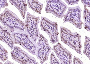 Phospho-Beta-Catenin (Ser33 + Ser37) Rabbit Polyclonal Antibody