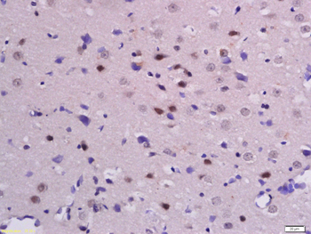 Phospho-Beta-Catenin (Ser33 + Ser37) Rabbit Polyclonal Antibody