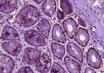 Phospho-Beta Catenin (Ser45) Rabbit Polyclonal Antibody