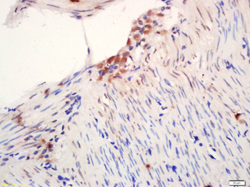 Phospho-Beta Catenin (Ser45) Rabbit Polyclonal Antibody