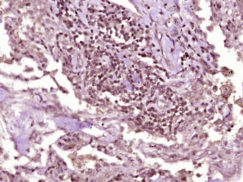 Phospho-Beta Catenin (Ser675) Rabbit Polyclonal Antibody