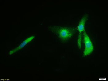 Phospho-Beta Catenin (Thr41 + Ser45) Rabbit Polyclonal Antibody