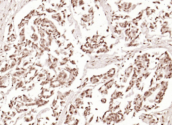 Phospho-Beta Catenin (Thr41 + Ser45) Rabbit Polyclonal Antibody