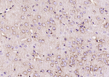 CACNA1G Rabbit Polyclonal Antibody