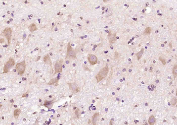 CACNA1A Rabbit Polyclonal Antibody