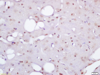 CBX8 Rabbit Polyclonal Antibody