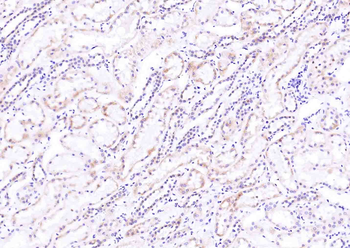 CYLD Rabbit Polyclonal Antibody