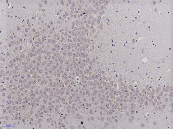 CYLD Rabbit Polyclonal Antibody