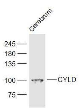 CYLD Rabbit Polyclonal Antibody