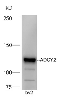 ADCY2 Rabbit Polyclonal Antibody