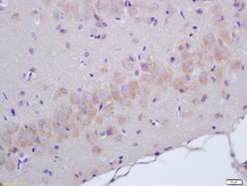 ADCY2 Rabbit Polyclonal Antibody