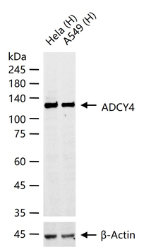 ADCY4 Rabbit Polyclonal Antibody