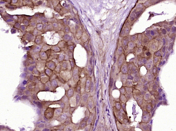 KIR2DL4 Rabbit Polyclonal Antibody