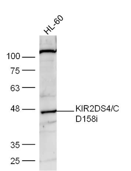 KIR2DS4/CD158i Rabbit Polyclonal Antibody