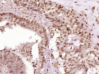 Phospho-CDK1 (Thr14) Rabbit Polyclonal Antibody